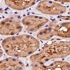 Human Dkk‑2 Antibody MAB6628