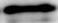 Human PKC zeta  Antibody MAB6666