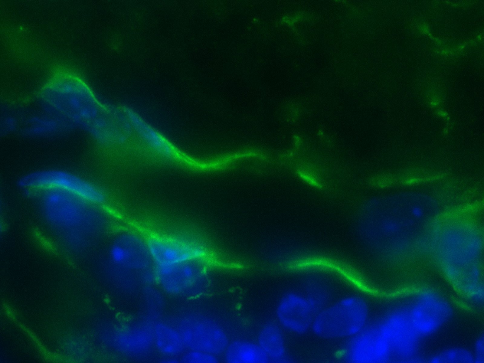 Mouse NG2/MCSP Antibody MAB6689