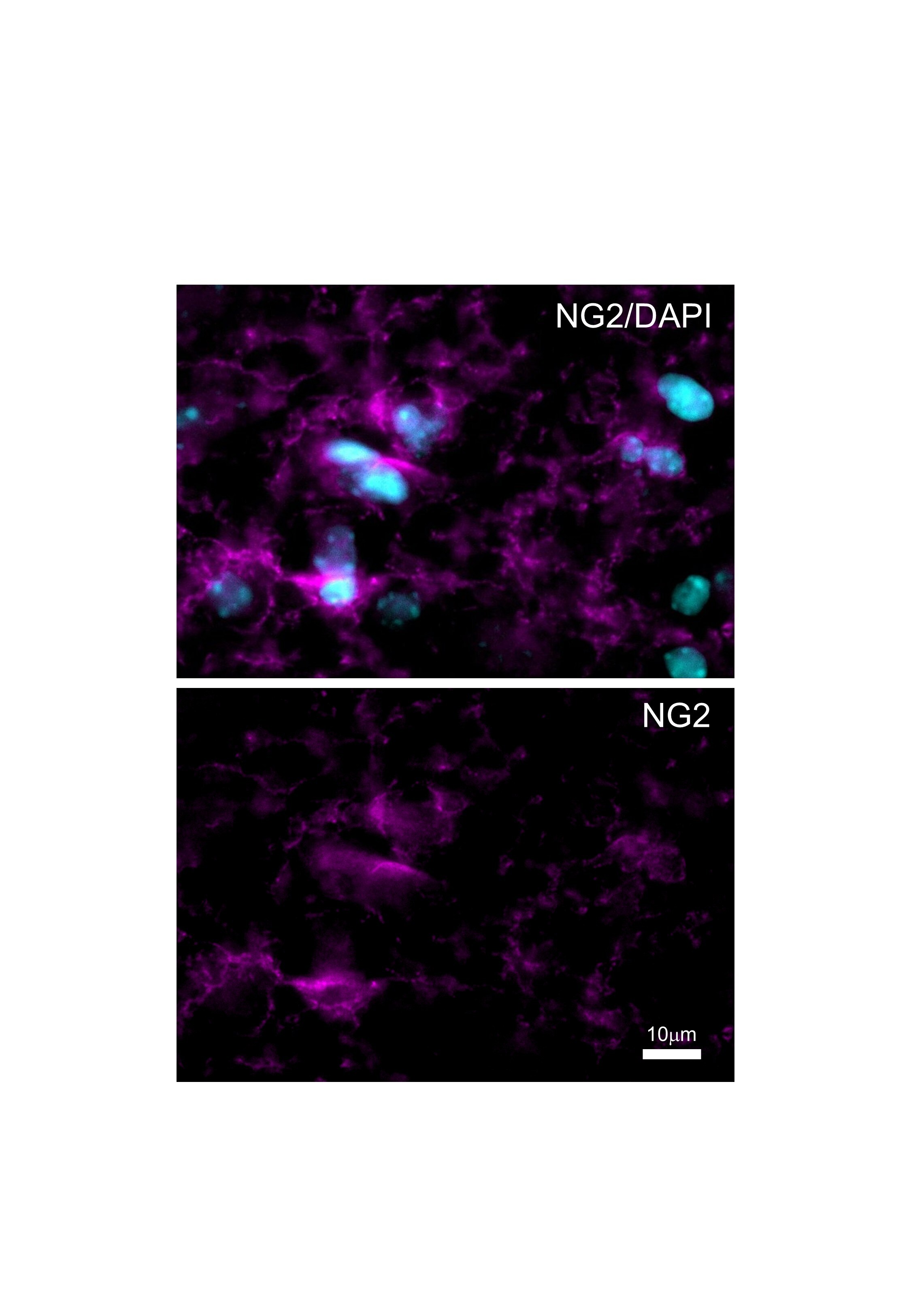 Mouse NG2/MCSP Antibody MAB6689
