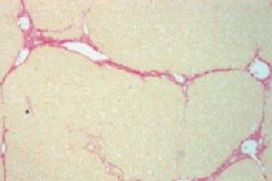 Human Follistatin Antibody MAB669