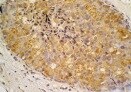 Human Follistatin Antibody MAB669