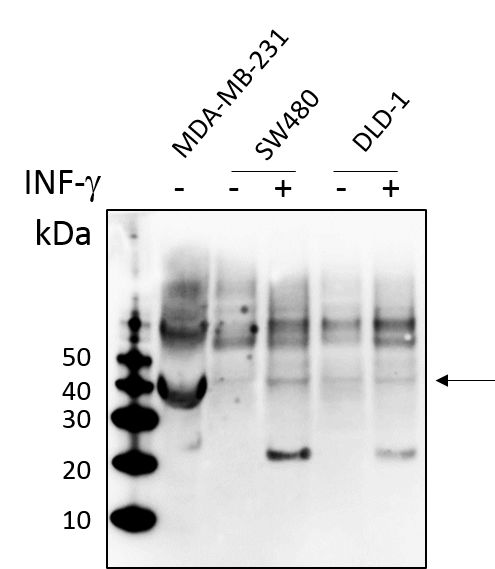 Human IFN‑ gamma  R1/CD119 Antibody MAB6731