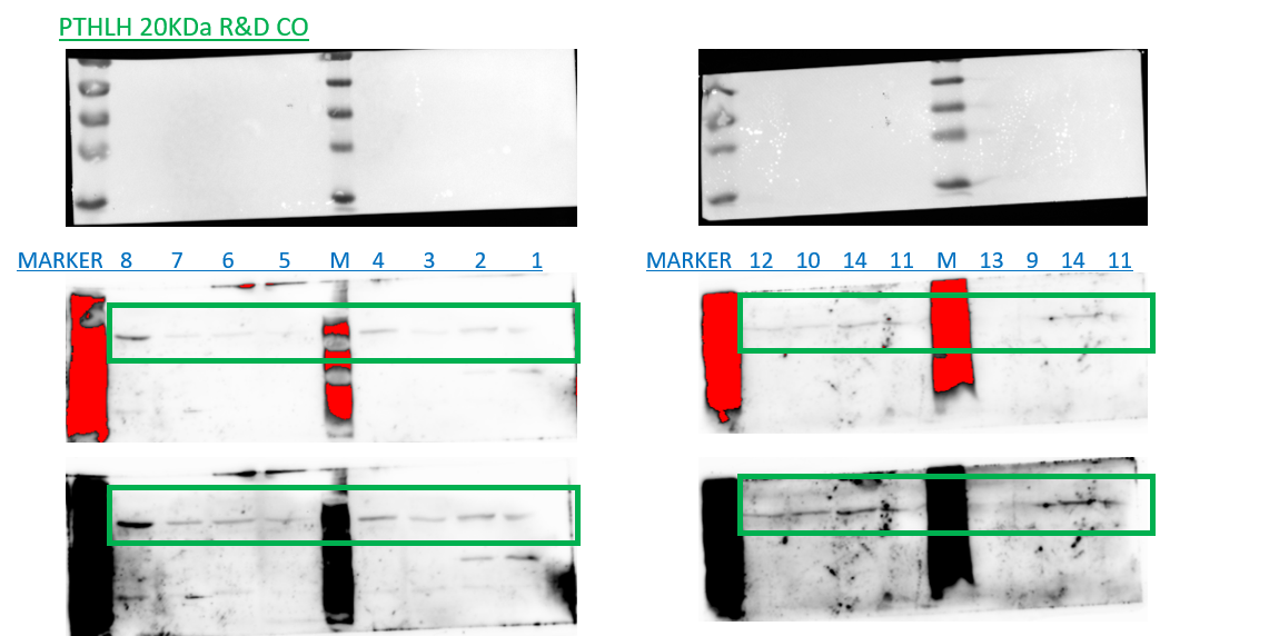 Human PTHLH/PTHrP Antibody MAB6734