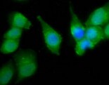 Mouse CLEC9a Antibody MAB67761