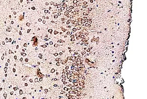 Human/Mouse MEF2C Antibody MAB6786