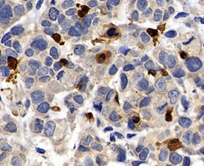 Human NLRP1/NALP1 Antibody MAB6788