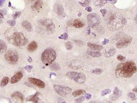 Human Cyclin E1 Antibody MAB6810
