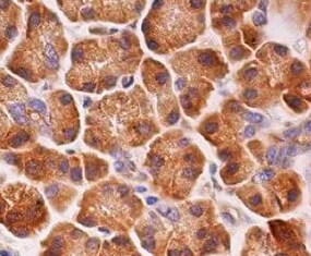 Human FGFR4 Antibody MAB6852