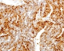 Human Troponin I/TNNI3 Antibody MAB68871