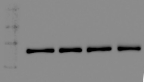 Human/Mouse/Rat Vinculin Antibody MAB6896