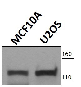 Human/Mouse/Rat Vinculin Antibody MAB6896