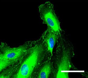 Human/Mouse/Rat Vinculin Antibody MAB6896