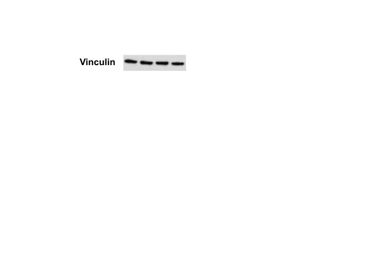 Human/Mouse/Rat Vinculin Antibody MAB6896