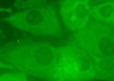 Human/Mouse/Rat Vinculin Antibody MAB6896