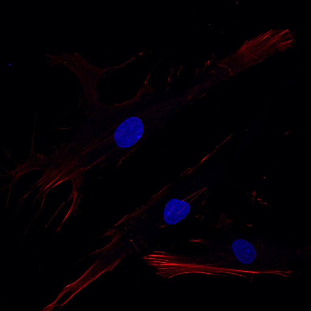 Human/Mouse/Rat Vinculin Antibody MAB6896