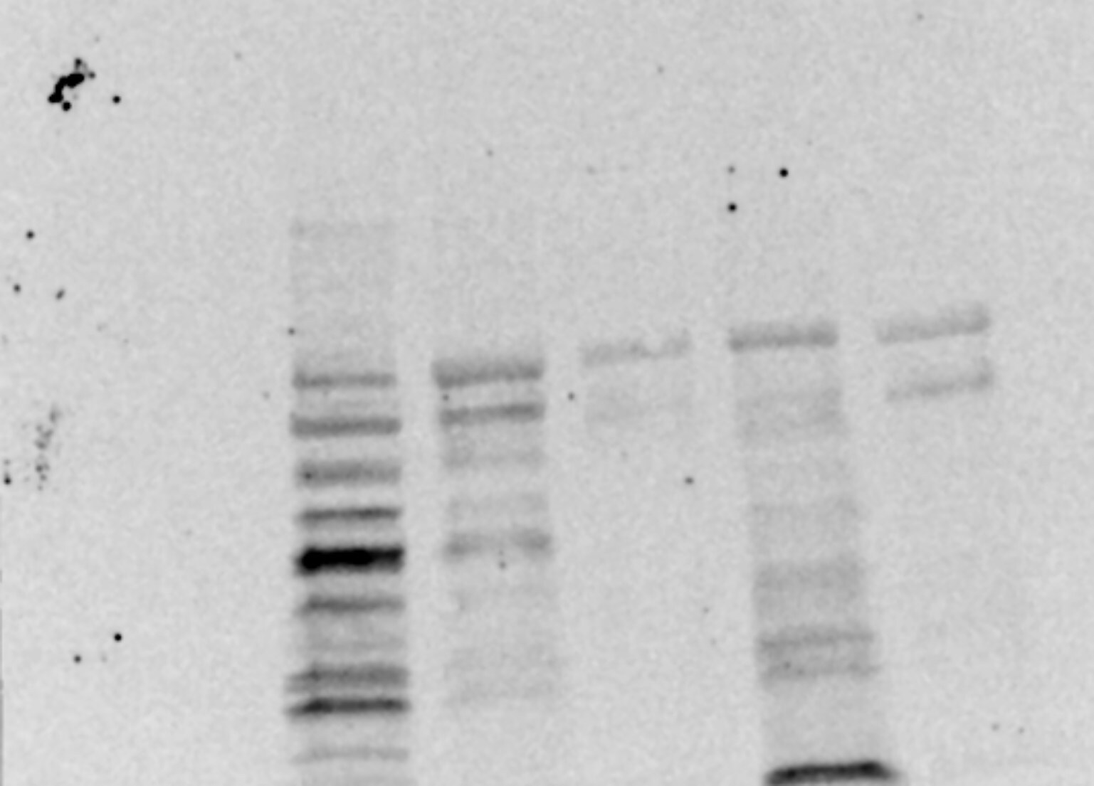 Human/Mouse/Rat Vinculin Antibody MAB6896