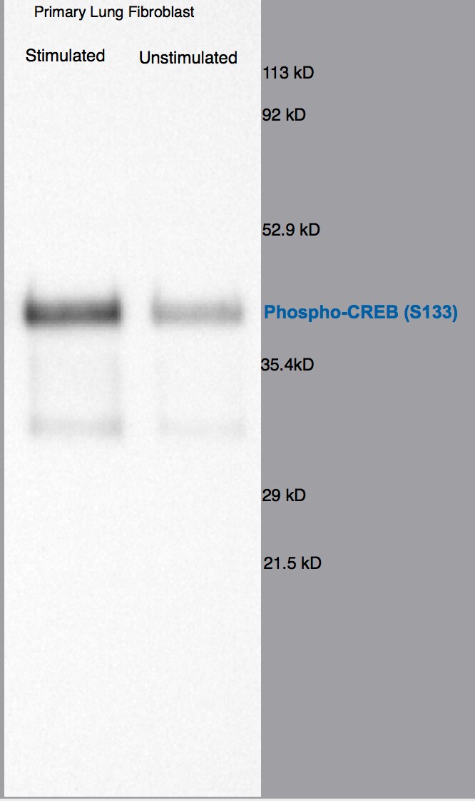 Human Phospho-CREB (S133) Antibody MAB6906