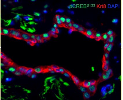 Human Phospho-CREB (S133) Antibody MAB6906