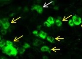 Human Phospho-CREB (S133) Antibody MAB6906