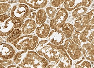 Human Tensin 4/CTEN Antibody MAB6925