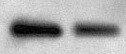 Human HGF Antibody MAB694