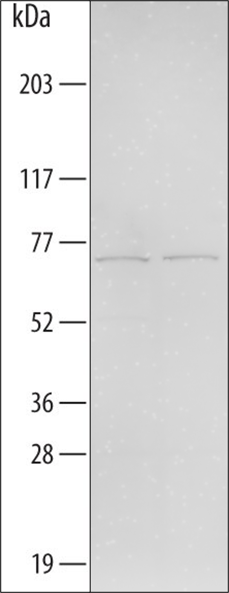 Human DMPK Antibody MAB6967