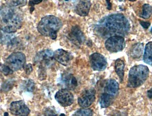 Human STIM1 Antibody MAB69761
