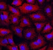 Human/Mouse/Rat Zyxin Antibody MAB6977