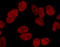 Human DEK Antibody MAB70201