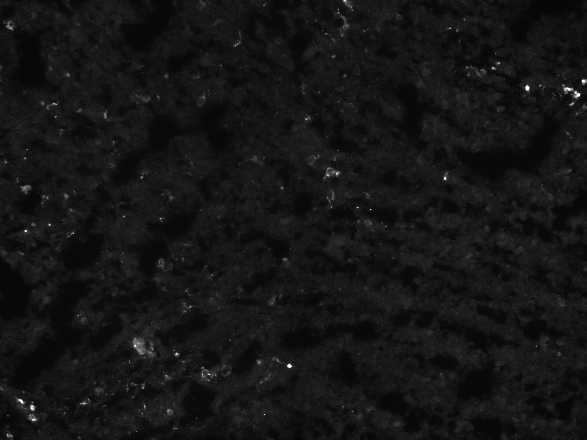 Human KLRG1 Antibody MAB70293