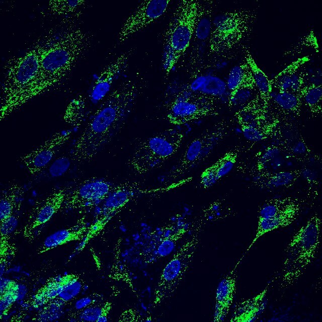 Human Occludin Antibody MAB7074