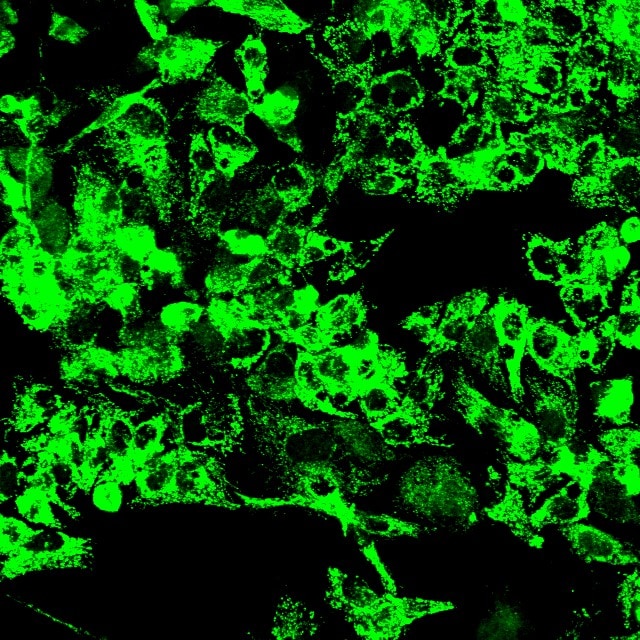 Human Occludin Antibody MAB7074