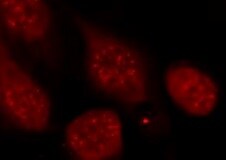 Human CEBP  alpha  Antibody MAB7094