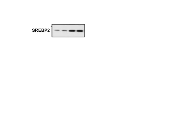 Human SREBP2 Antibody MAB7119