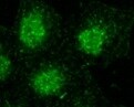 Human/Mouse/Rat MEKK2 Antibody MAB7128