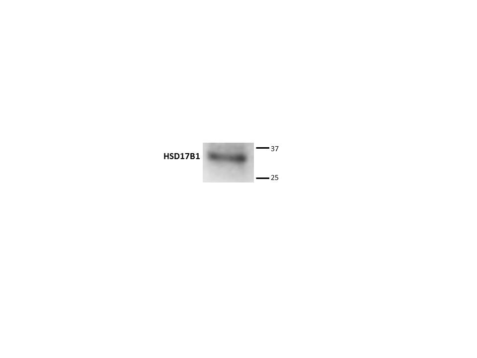 Human 17 beta-HSD1/HSD17B1 Antibody MAB7178
