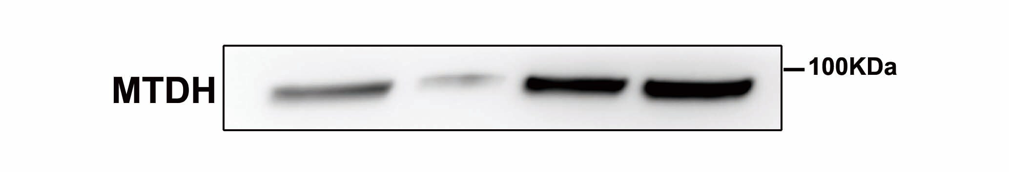 Mouse Metadherin Antibody MAB7180