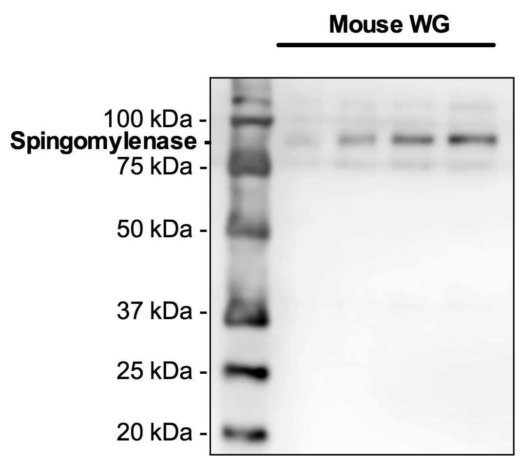 Human SMPD3 Antibody MAB7184