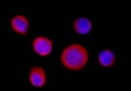 Human Phospho-BTK (Y223) Antibody MAB7205