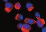 Human ICAM‑1/CD54 Antibody MAB720
