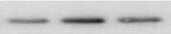 Human Phospho-RelA/NFkB p65 (S536) Antibody MAB7226