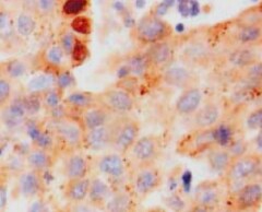 Human Syntaxin 1A Antibody MAB7237