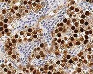 Human Ezrin Antibody MAB7239