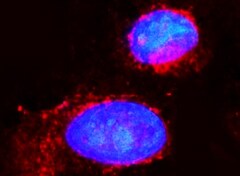 Human Rab27a Antibody MAB7245