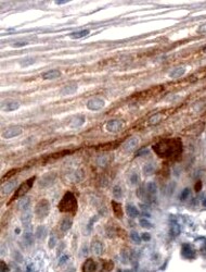 Mouse CCL27/CTACK Antibody MAB7251