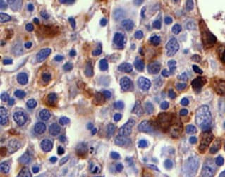 Human AIF-1/Iba1 Antibody MAB7308