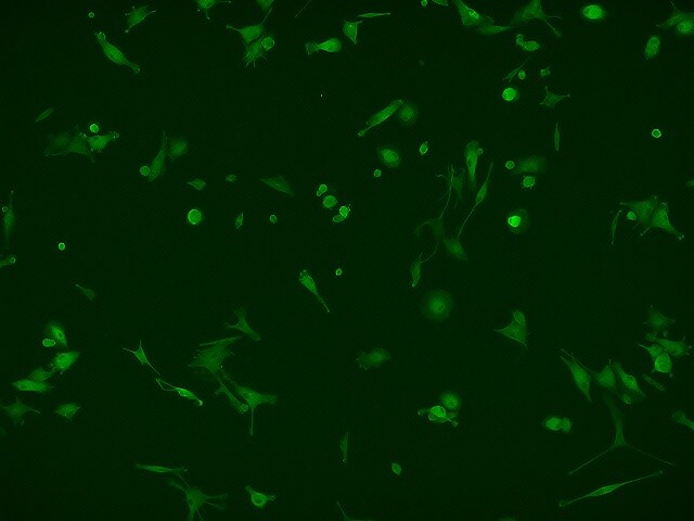 Human AIF-1/Iba1 Antibody MAB7308