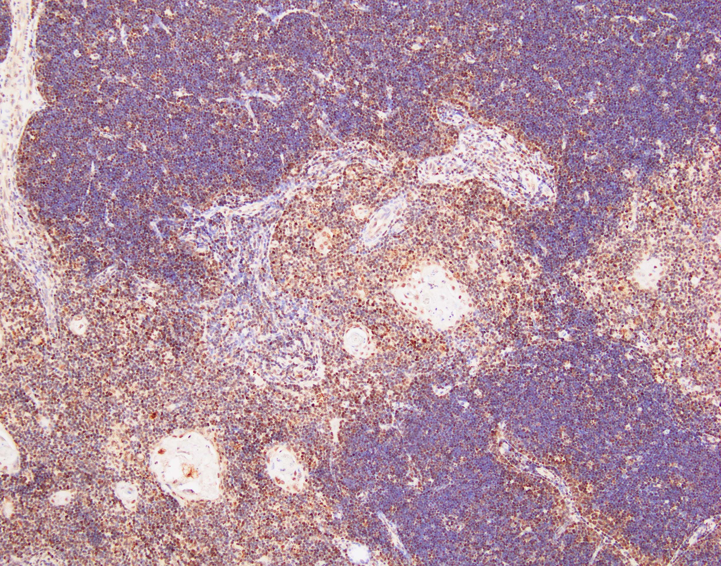 Human Helios Antibody MAB73091