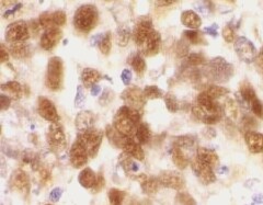 Human/Mouse/Rat PDCD5 Antibody MAB7325